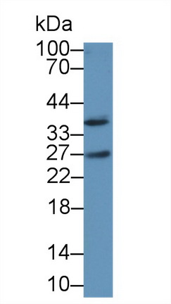 白介素1α(IL1a)多克隆抗体