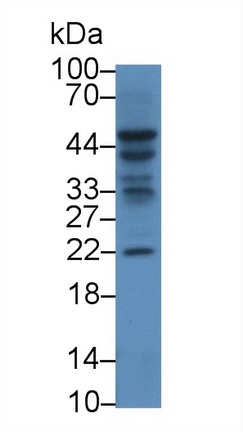 白介素1α(IL1a)多克隆抗体