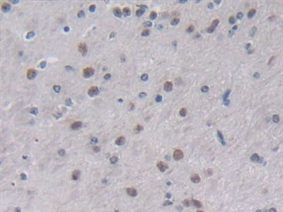 白介素2(IL2)多克隆抗體