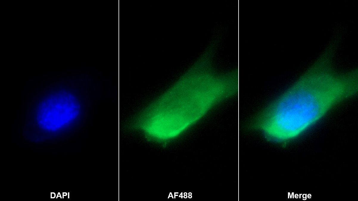 瘦素(LEP)多克隆抗體