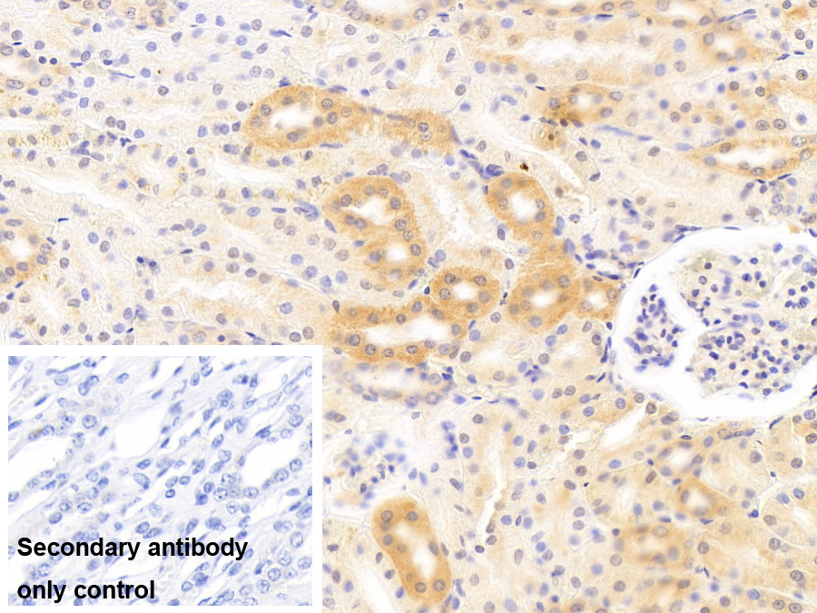 单核细胞趋化蛋白1(MCP1)多克隆抗体