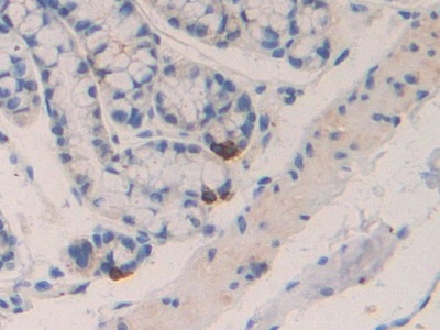 巨噬细胞炎性蛋白1β(MIP1b)多克隆抗体