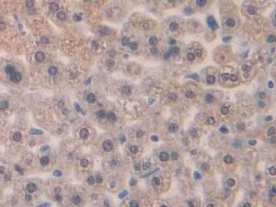 巨噬细胞炎性蛋白1β(MIP1b)多克隆抗体