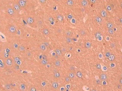 巨噬细胞炎性蛋白1β(MIP1b)多克隆抗体