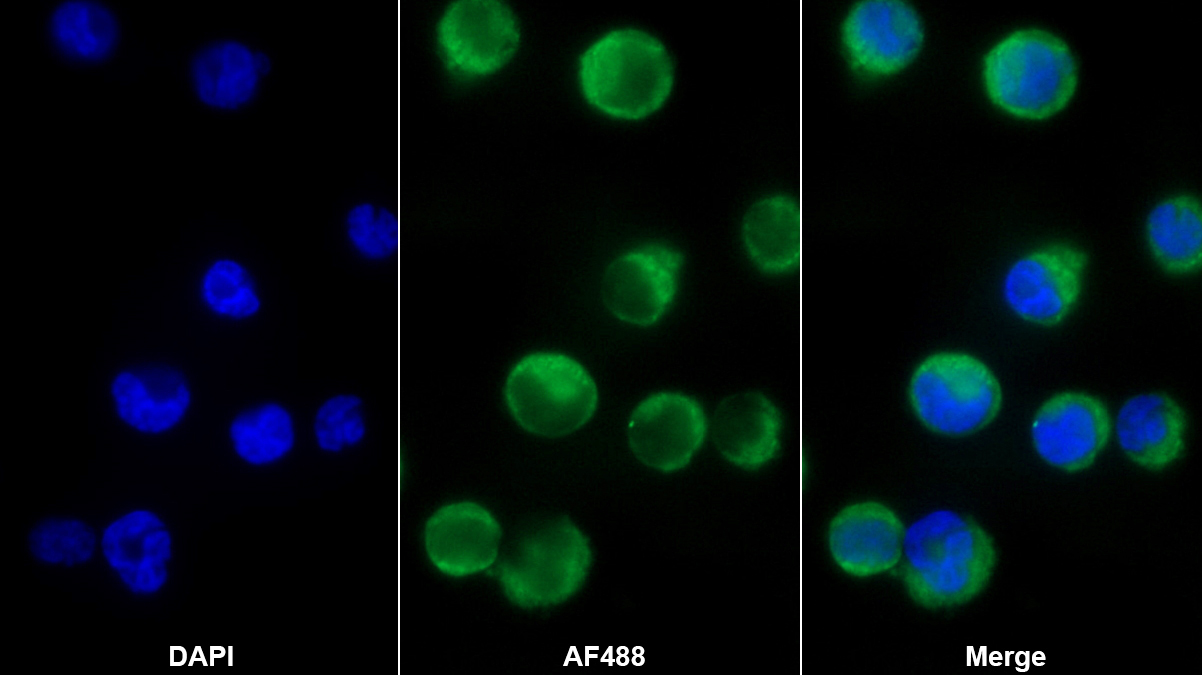 巨噬細(xì)胞炎性蛋白3β(MIP3b)多克隆抗體
