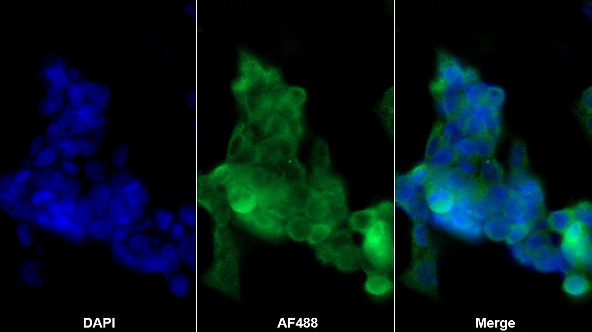 肌肌酸激酶(CKM)多克隆抗體