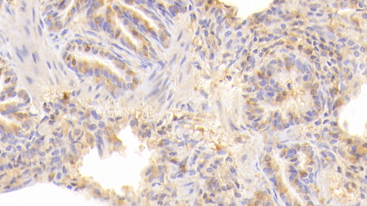 CD40配體(CD40L)多克隆抗體