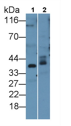 脂聯(lián)素受體2(ADIPOR2)多克隆抗體