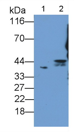 脂聯(lián)素受體2(ADIPOR2)多克隆抗體