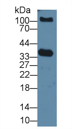 激肽釋放酶3(PSA)多克隆抗體