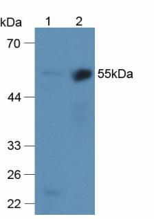 α2-抗纖維蛋白溶酶(a2PI)多克隆抗體