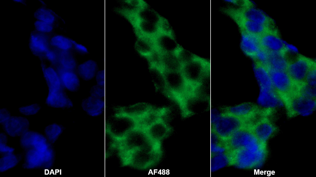 α2-抗纤维蛋白溶酶(a2PI)多克隆抗体