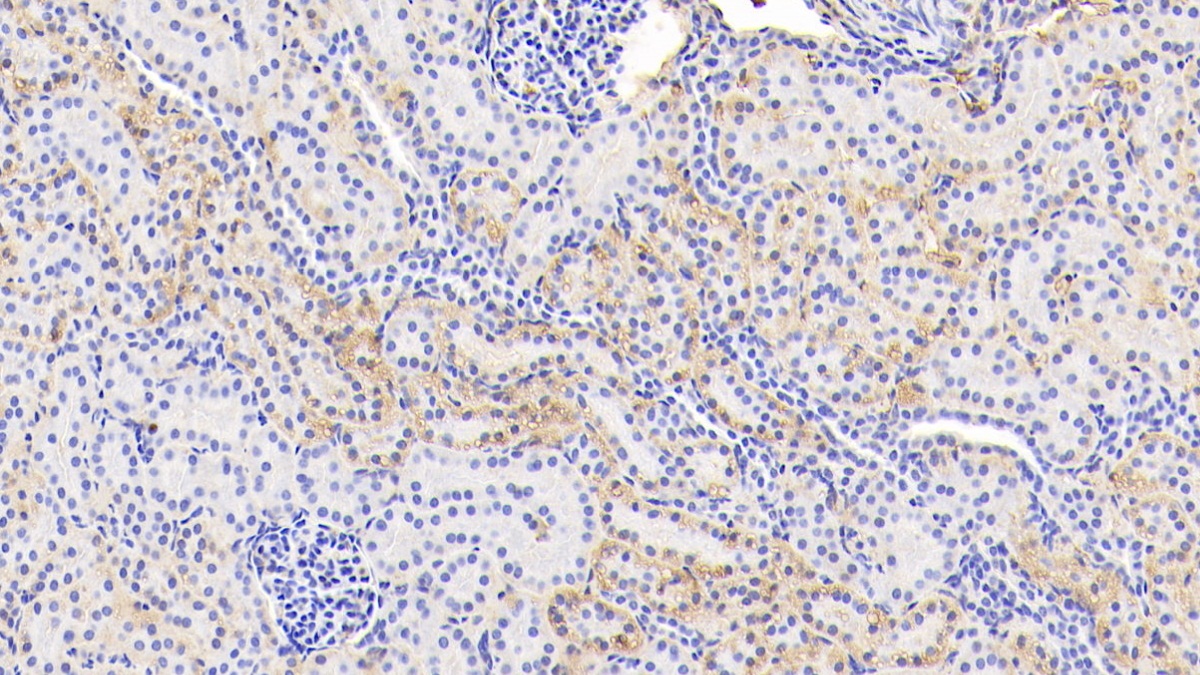 糖化血红蛋白A1c(HbA1c)多克隆抗体