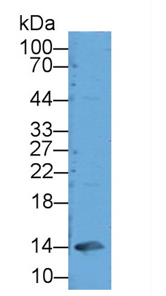 糖化血紅蛋白A1c(HbA1c)多克隆抗體