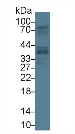 生長停滯特異性蛋白2(GAS2)多克隆抗體