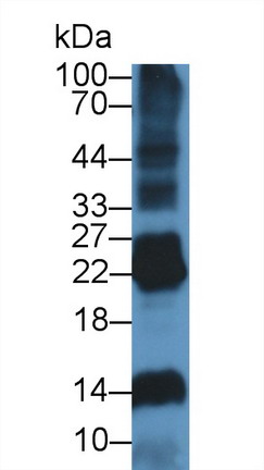 脱氧核糖核酸酶Ⅰ样2(DNASE1L2)多克隆抗体