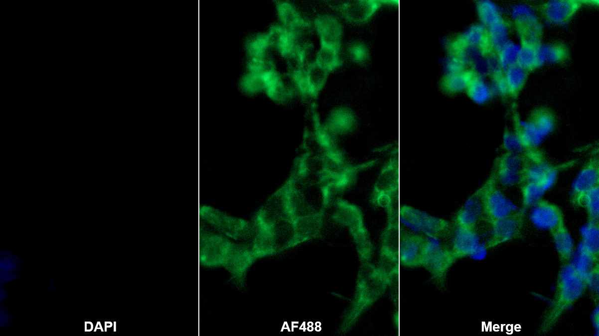谷丙轉(zhuǎn)氨酶(ALT)多克隆抗體