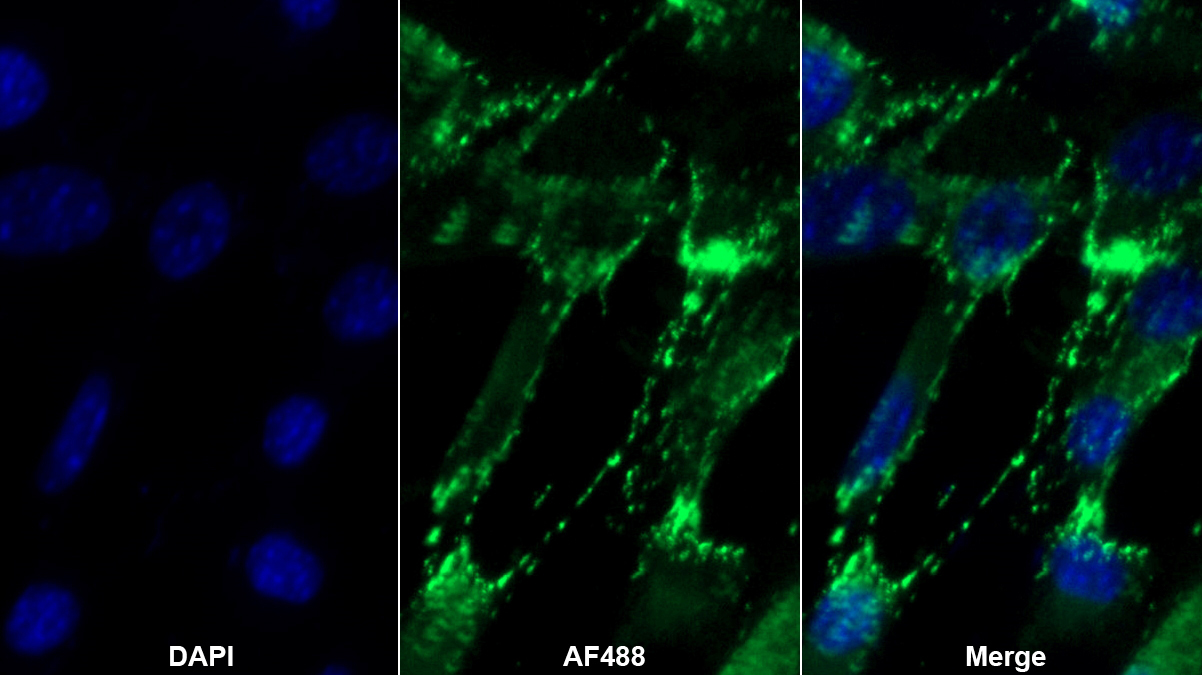 丙酮酸激酶同工酶R/L(PKLR)多克隆抗体