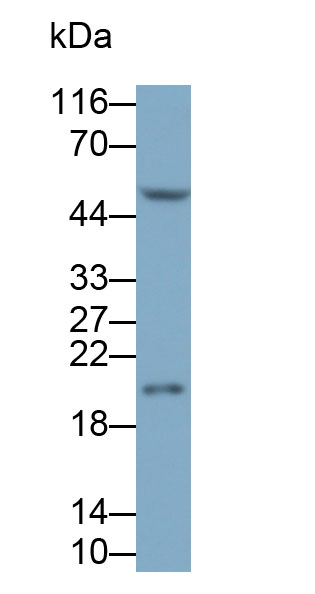 白介素1受體拮抗劑(IL1RA)多克隆抗體