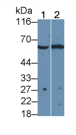 白介素2受體β(IL2Rb)多克隆抗體