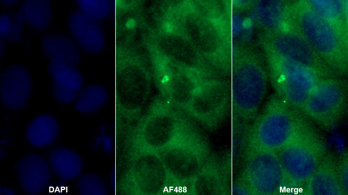 蛋白激酶Cη(PKCh)多克隆抗體