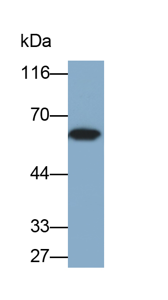 補體1抑制因子(C1INH)多克隆抗體