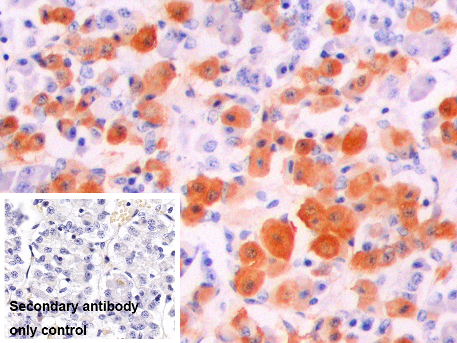 α-黑素細(xì)胞刺激素(aMSH)多克隆抗體