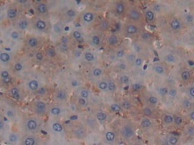 載脂蛋白C1(APOC1)多克隆抗體