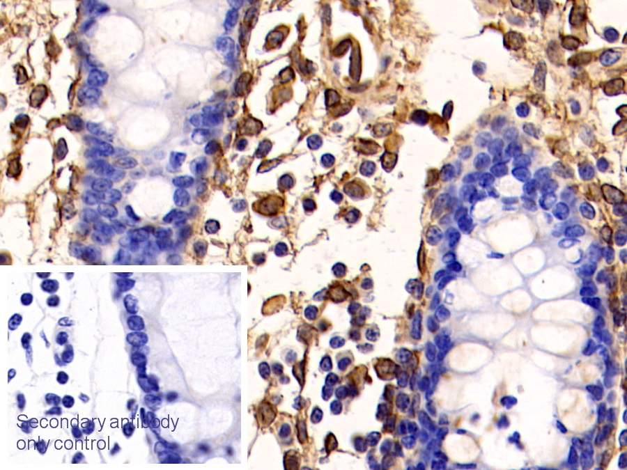 膜联蛋白A5(ANXA5)多克隆抗体