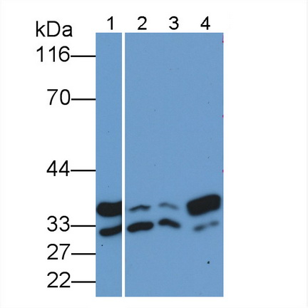 膜聯蛋白A5(ANXA5)多克隆抗體
