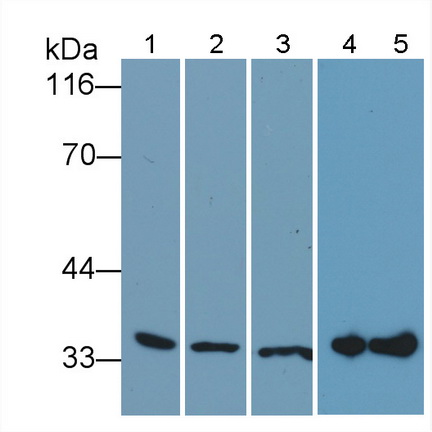 膜聯蛋白A5(ANXA5)多克隆抗體