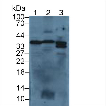 膜聯(lián)蛋白A5(ANXA5)多克隆抗體