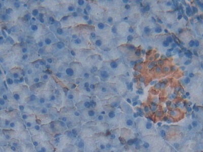 膜聯(lián)蛋白A5(ANXA5)多克隆抗體