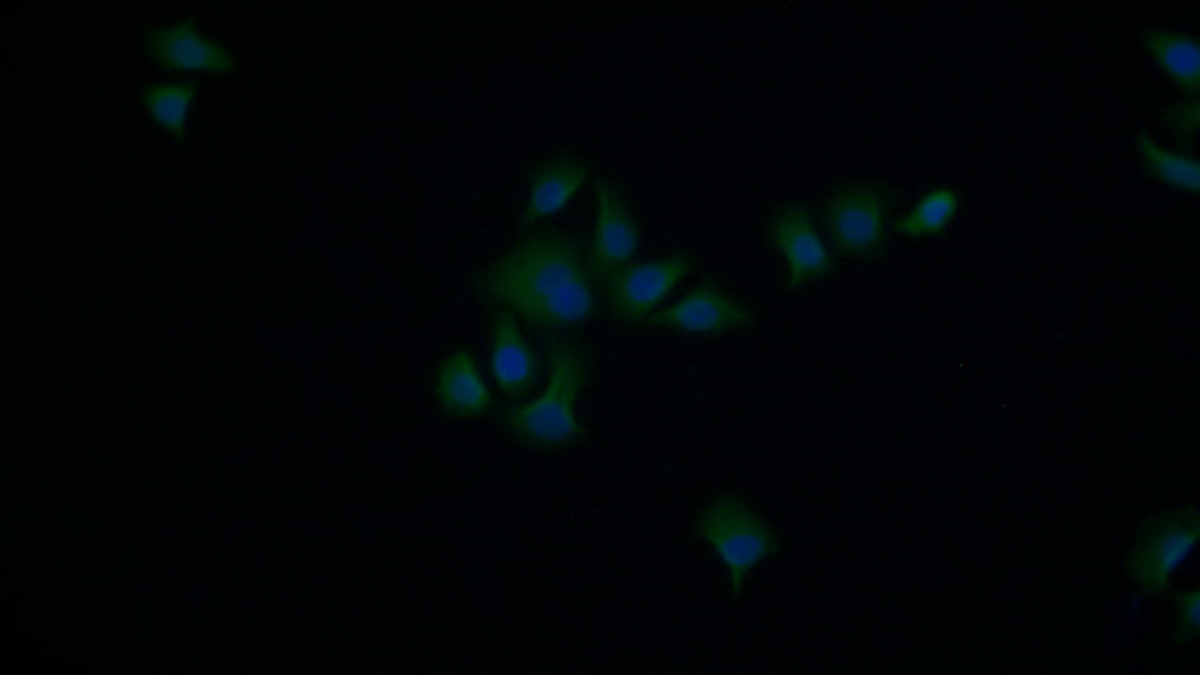 膜聯(lián)蛋白A5(ANXA5)多克隆抗體