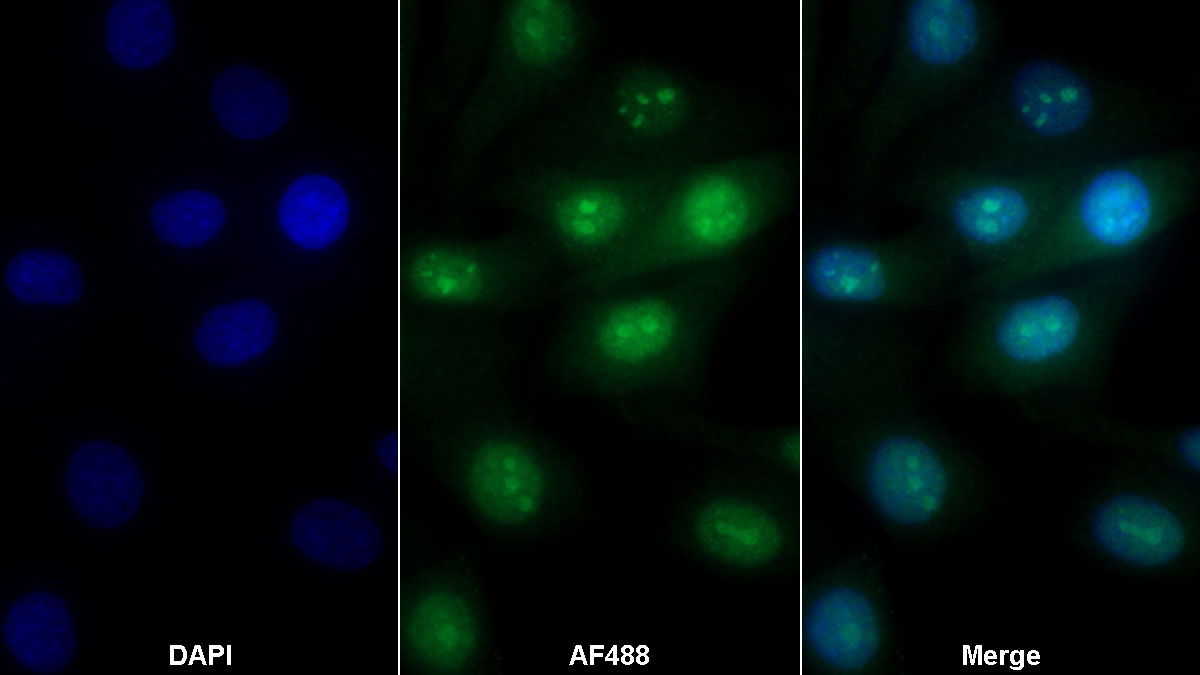 膜聯(lián)蛋白A5(ANXA5)多克隆抗體