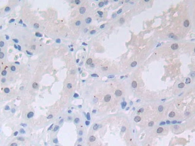 轉(zhuǎn)鐵蛋白受體2(TFR2)多克隆抗體