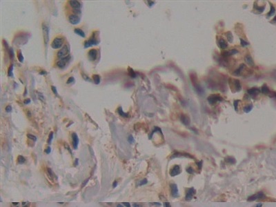线粒体肌酸激酶1A(CKMT1A)多克隆抗体