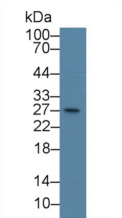 着丝粒蛋白H(CENPH)多克隆抗体