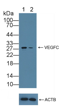 着丝粒蛋白H(CENPH)多克隆抗体
