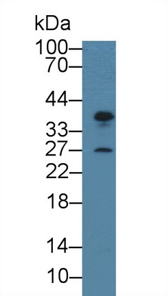 着丝粒蛋白H(CENPH)多克隆抗体
