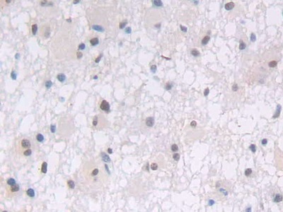 磷酯酶Cγ1(PLCg1)多克隆抗体