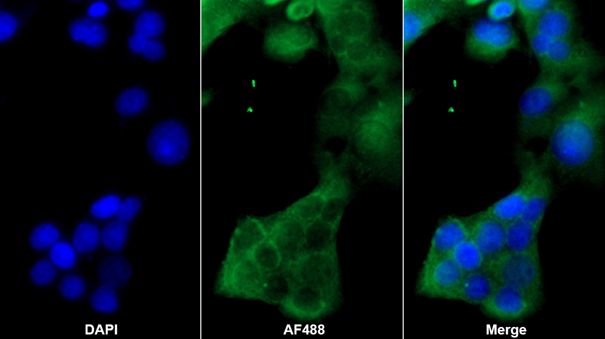 谷胱甘肽過氧化酶1(GPX1)多克隆抗體