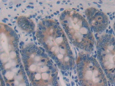 半乳糖凝集素2(GAL2)多克隆抗體