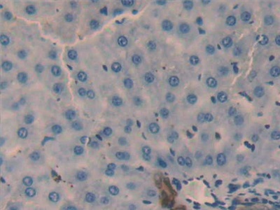 半乳糖凝集素2(GAL2)多克隆抗體