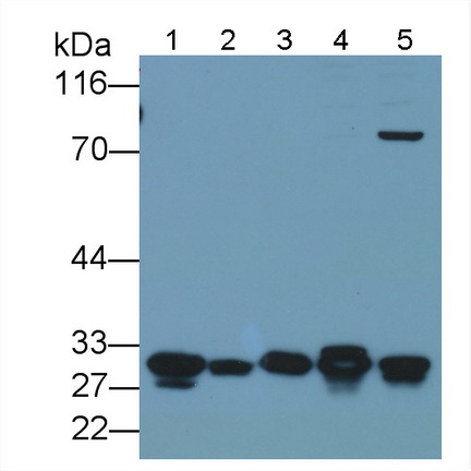 半乳糖凝集素3(GAL3)多克隆抗體