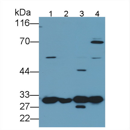 半乳糖凝集素3(GAL3)多克隆抗體