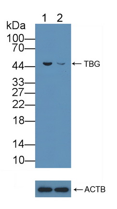 甲狀腺結(jié)合球蛋白(TBG)多克隆抗體