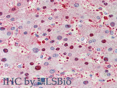 甲状腺结合球蛋白(TBG)多克隆抗体