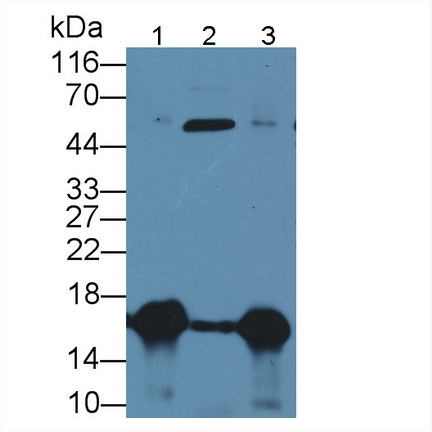 半乳糖凝集素7(GAL7)多克隆抗體
