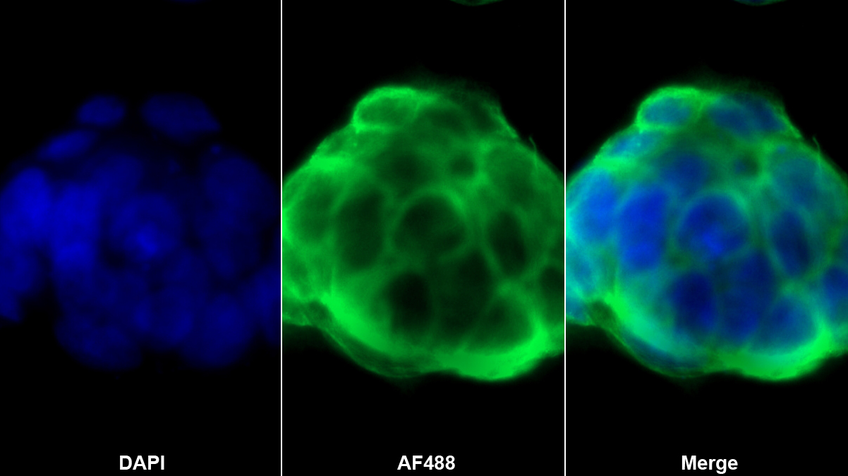 半乳糖凝集素7(GAL7)多克隆抗体